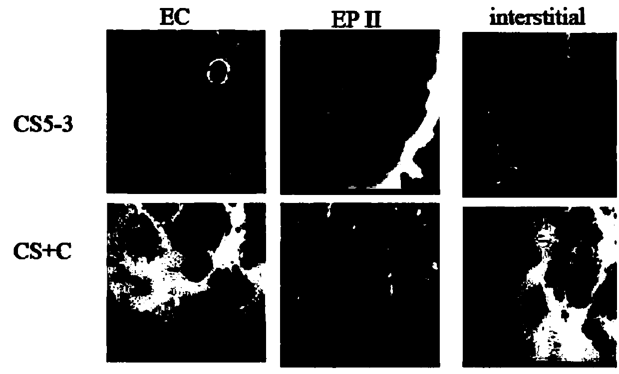 Application of calpain inhibitor to preparation of medicine for relieving lung inflammation caused by cigarette smoke