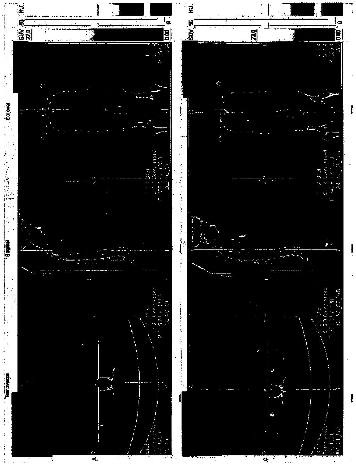 Metabolic targeting of cancer cells using chemotherapy and immunotherapy for the treatment of cancer