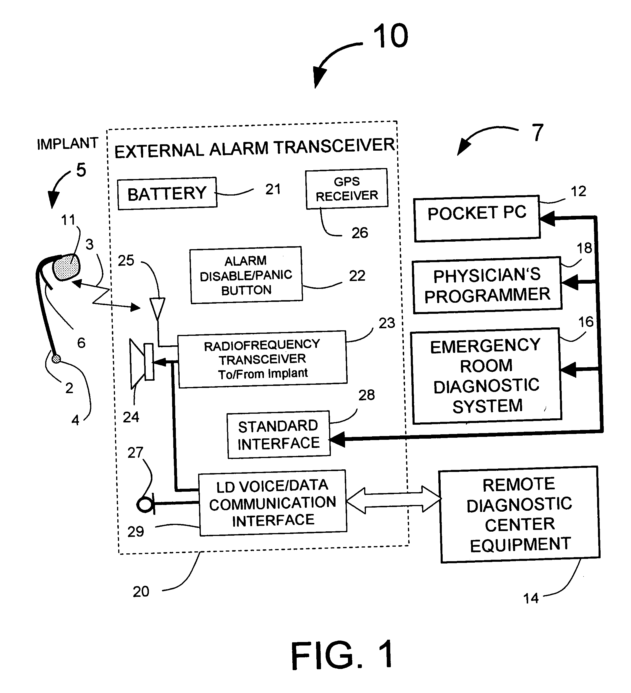 Electrogram signal filtering in systems for detecting ischemia