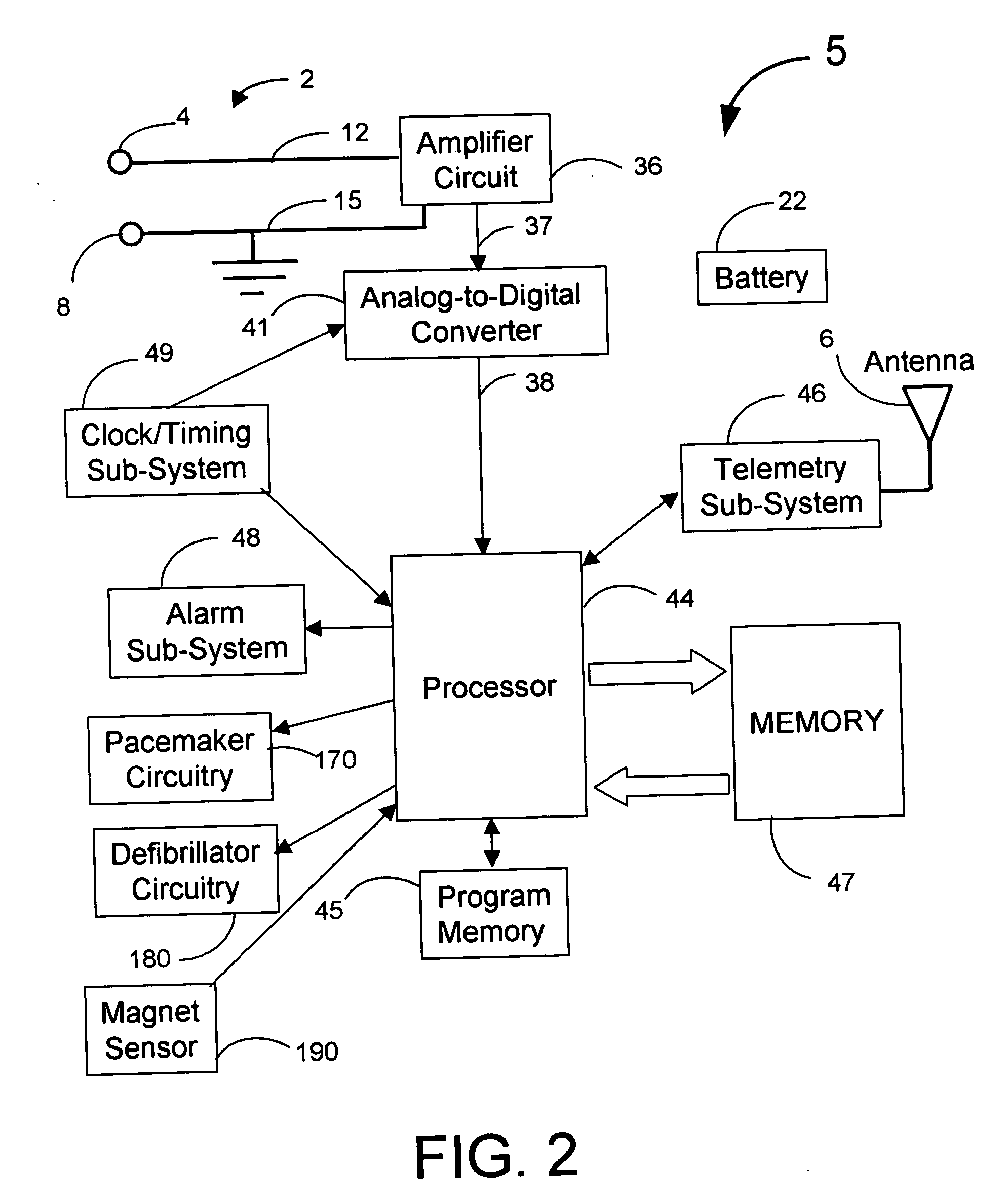 Electrogram signal filtering in systems for detecting ischemia