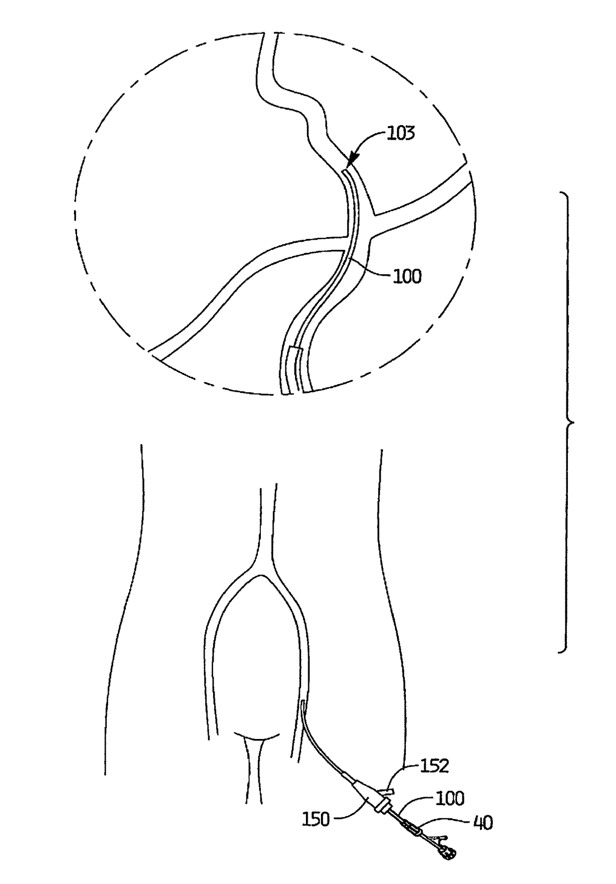 Rotational thrombectomy wire