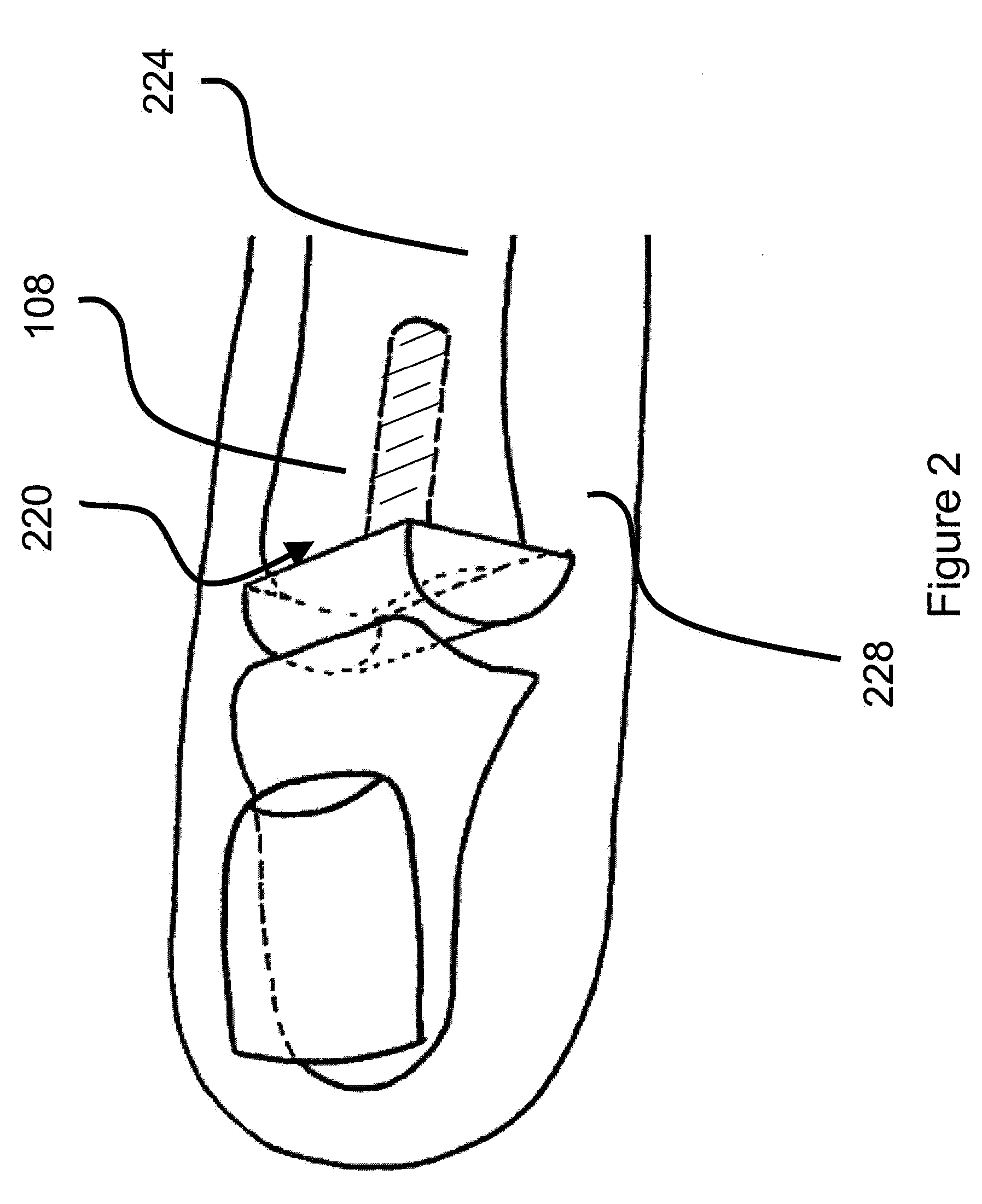 Small joint hemiarthroplasty