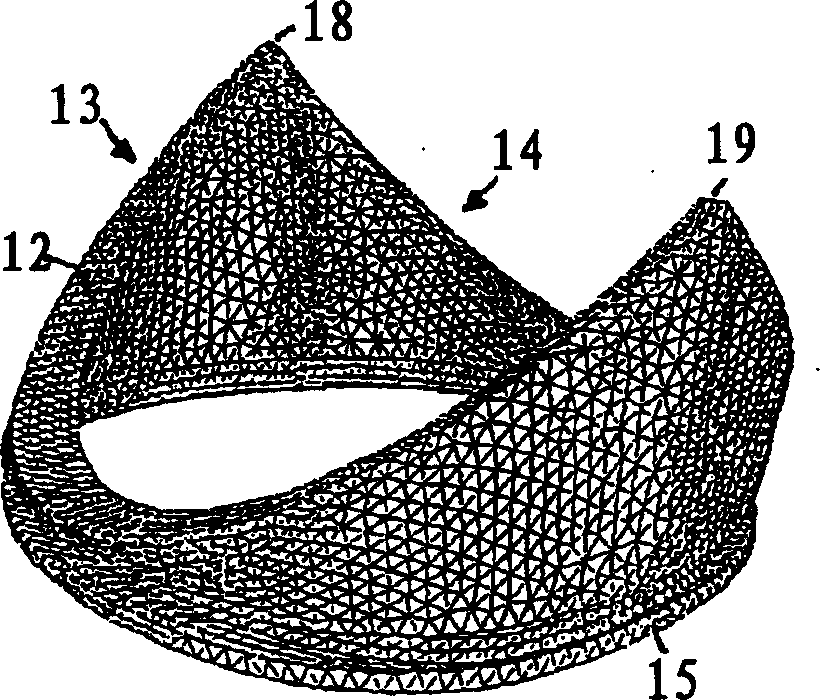 Prosthetic mitral heart valve