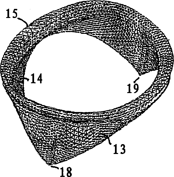 Prosthetic mitral heart valve