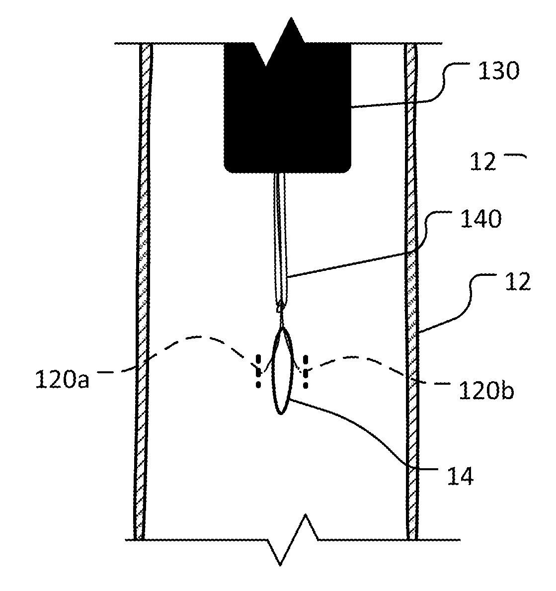 Endoluminal anastomosis and tissue closure devices