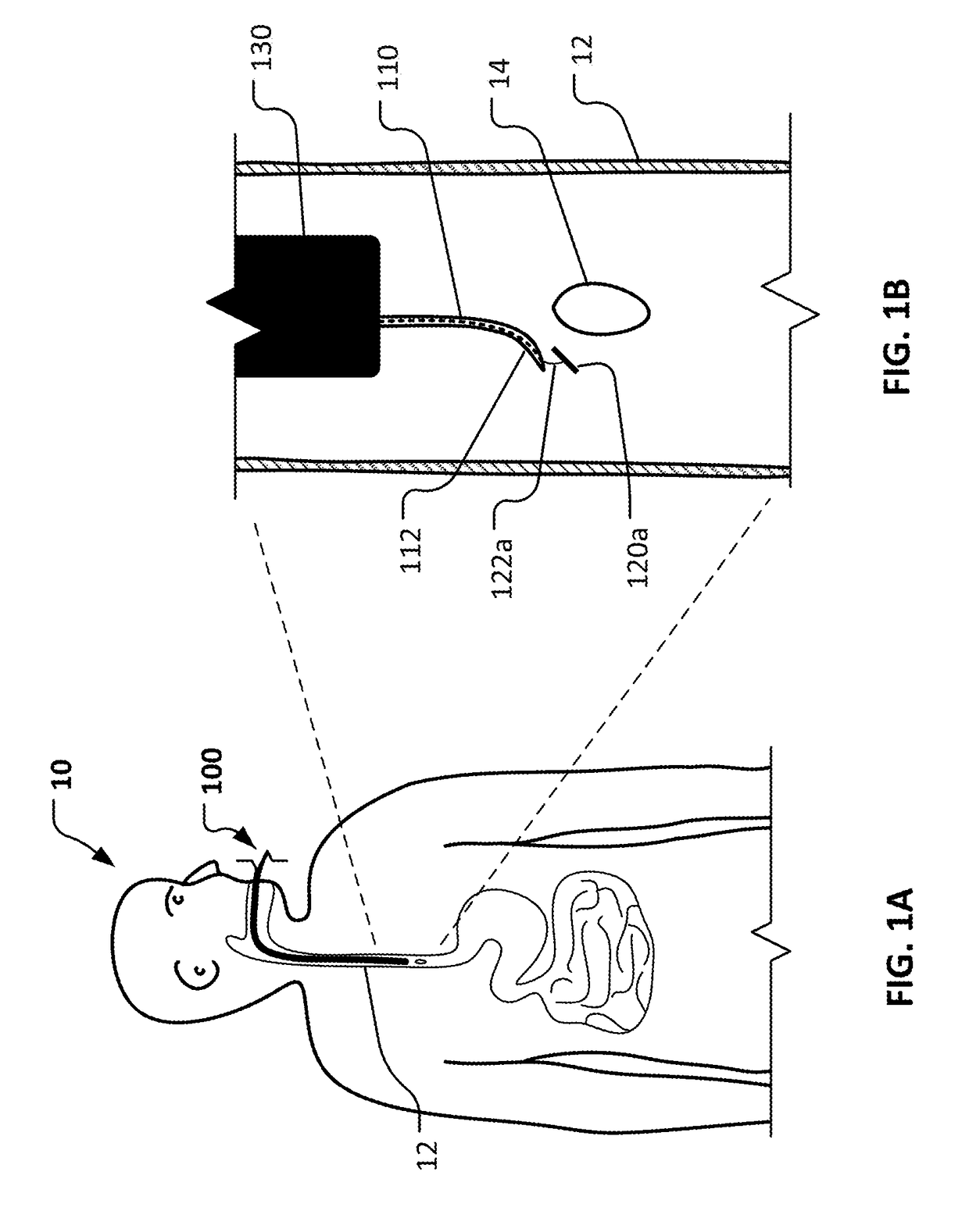 Endoluminal anastomosis and tissue closure devices