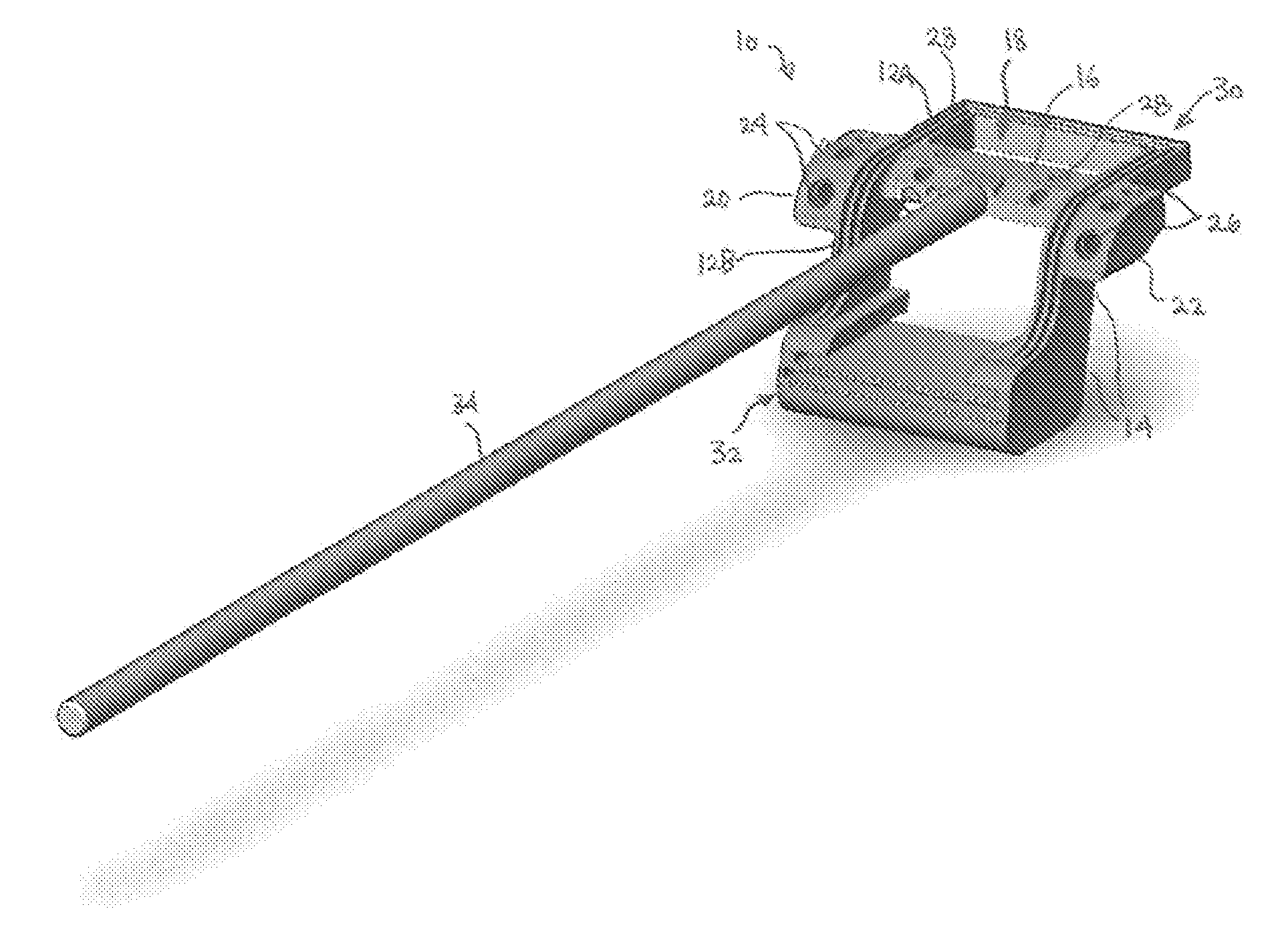 Allograft templates and methods of use