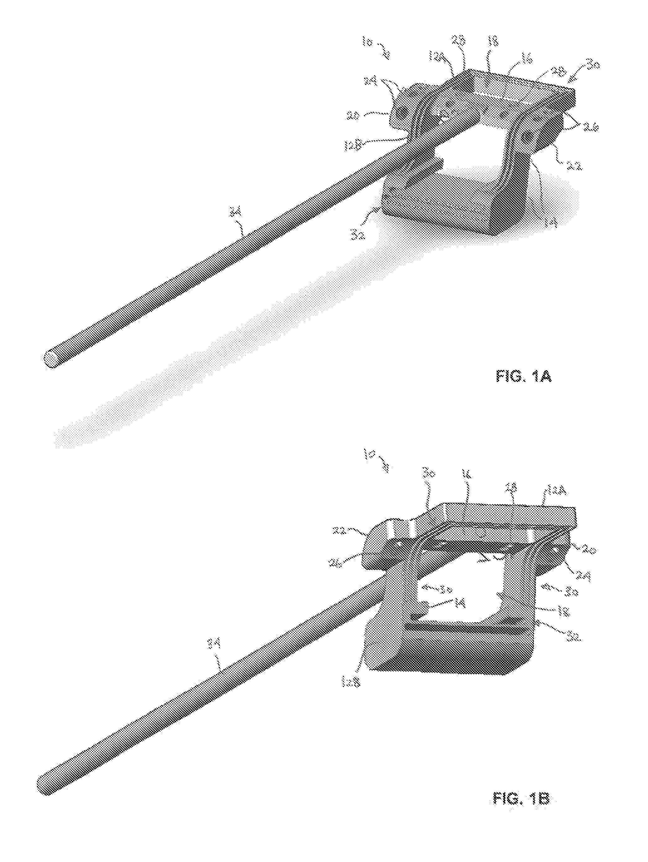 Allograft templates and methods of use