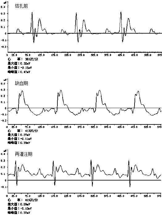 Phenylethyl o-nitrocaffeate and its preparation method and application