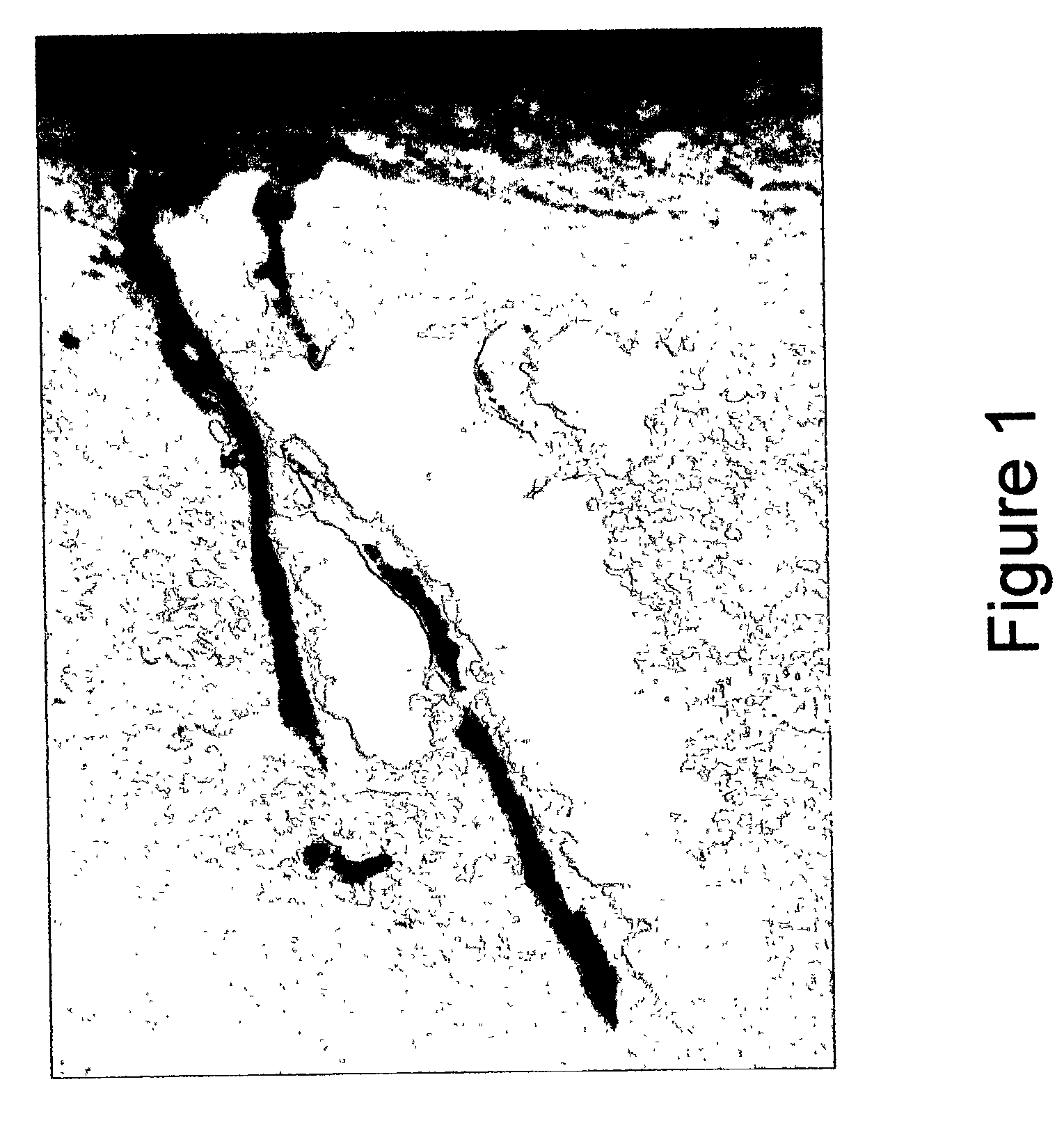 Measurement of elastic fiber breakdown products in sputum