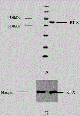 Method for producing antiangiogenesis agent RT-X in colibacillus and application of antiangiogenesis agent RT-X