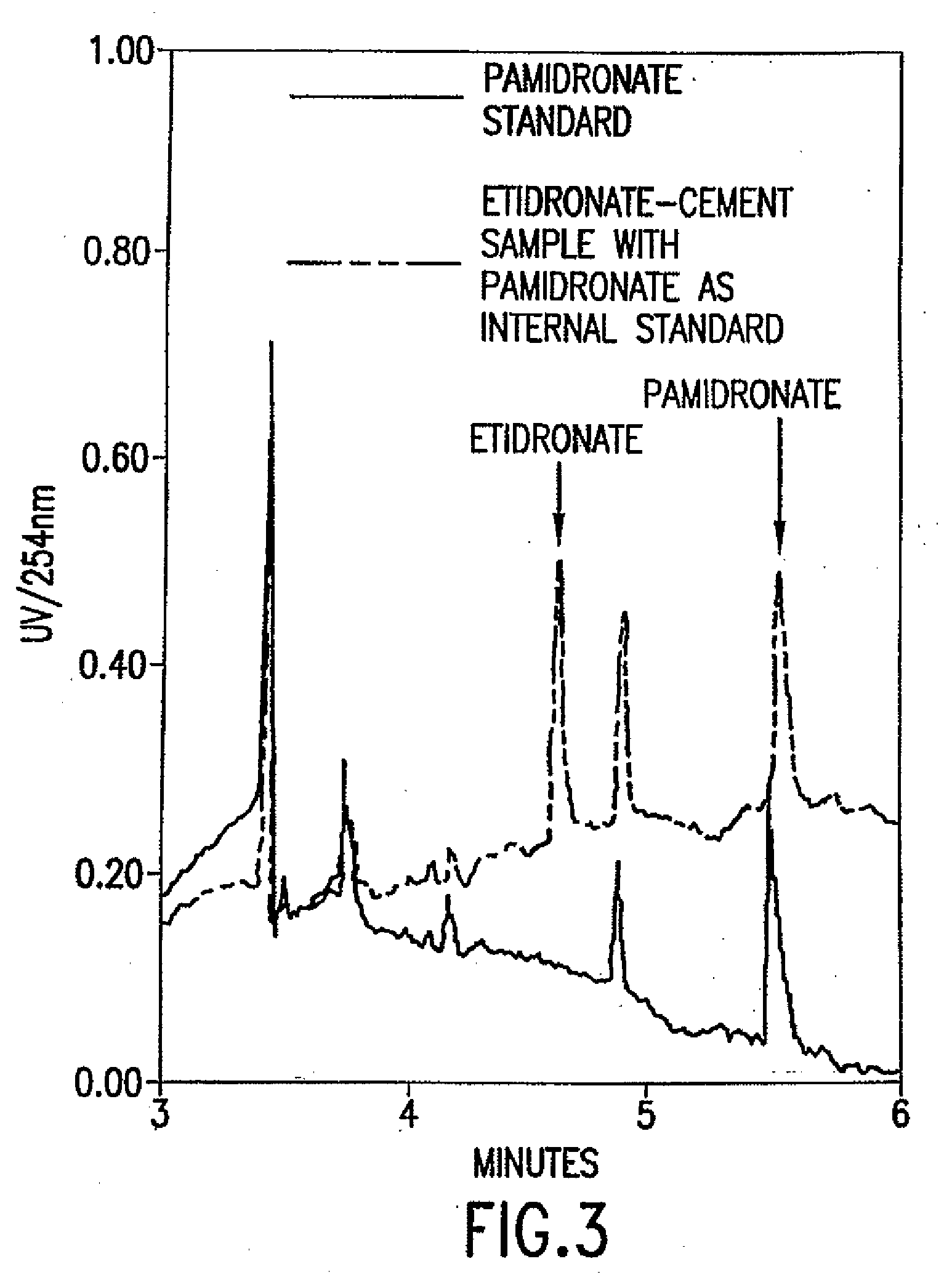 Anti-resorptive bone cements and allogeneic, autografic, and xenografic bone grafts