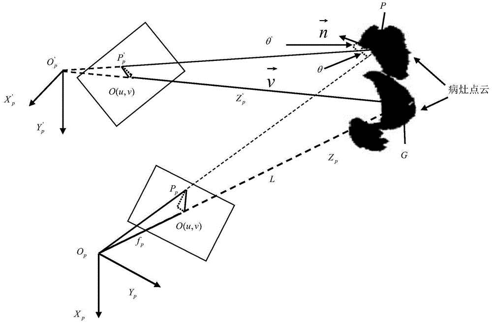 Optimization method of light projection direction in photodynamic therapy