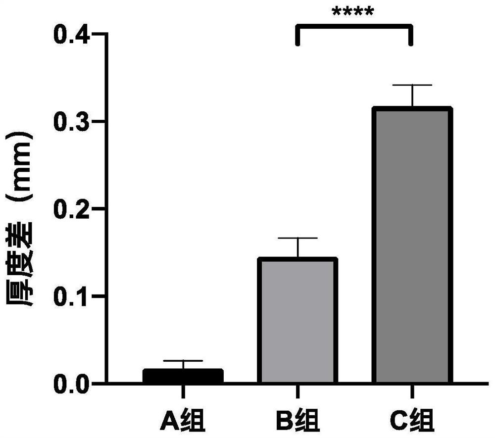 Pharmaceutical composition containing pharmaceutically acceptable salt of tofacitinib, preparation and application