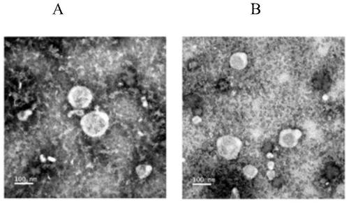 Application of human umbilical cord mesenchymal stem cell exosome