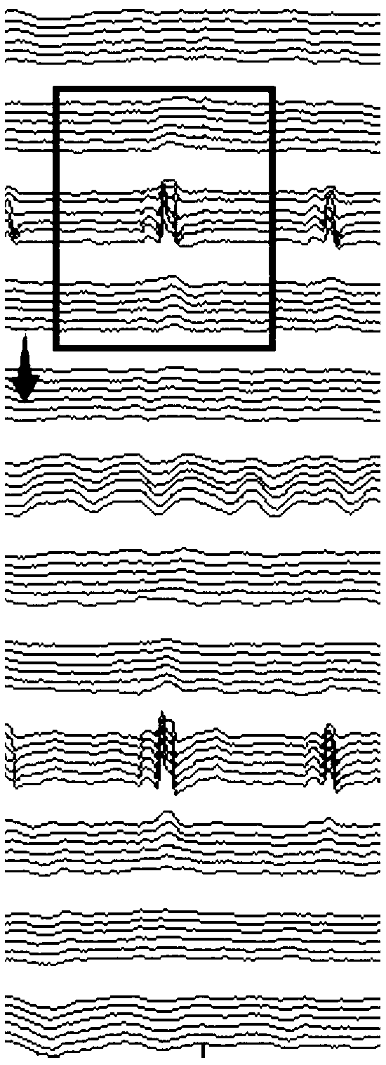 A pipeline anomaly classification method based on middle-level features