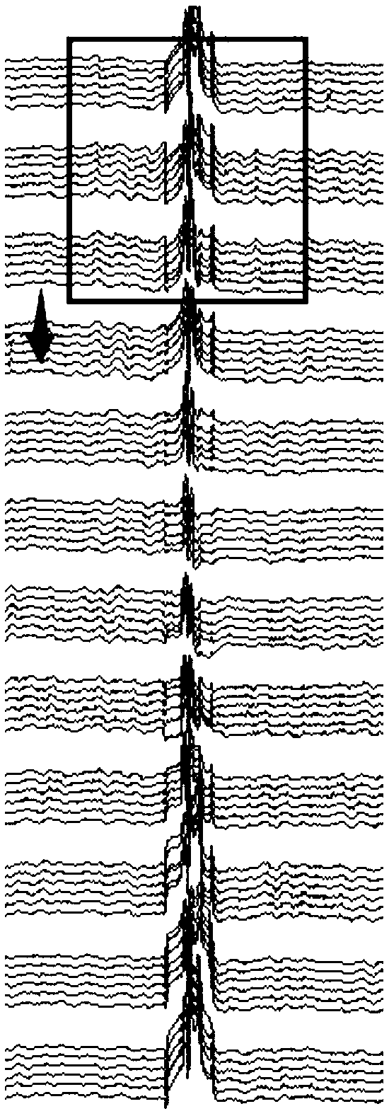 A pipeline anomaly classification method based on middle-level features