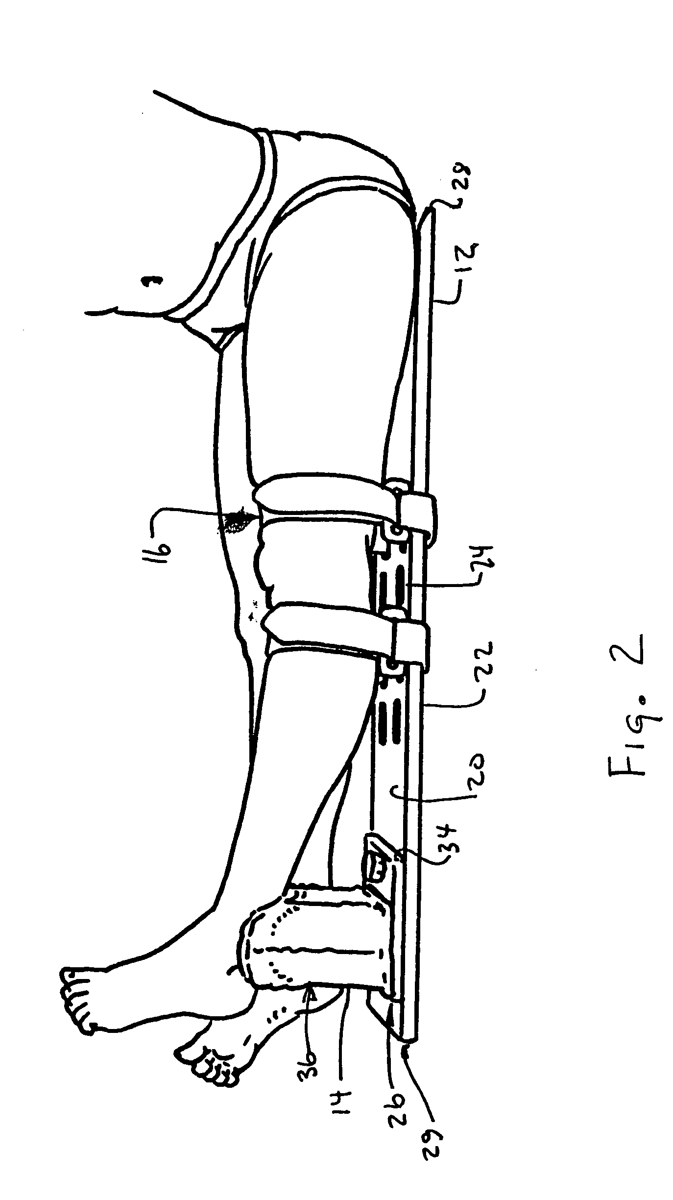 Knee extension apparatus