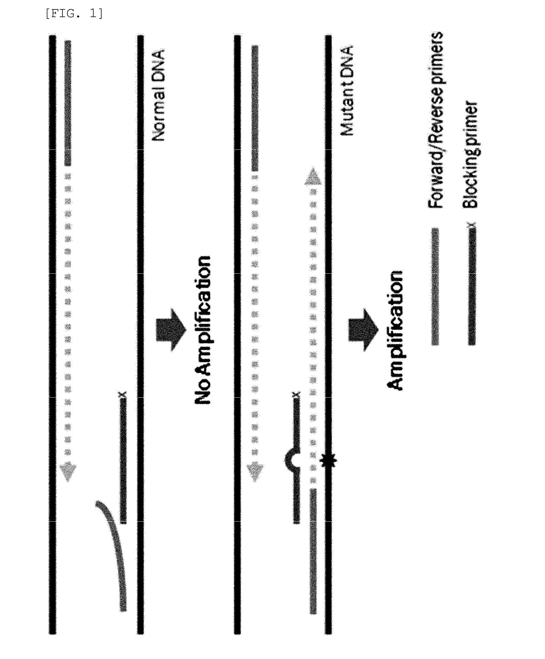 Method for detecting genetic mutation by using a blocking primer