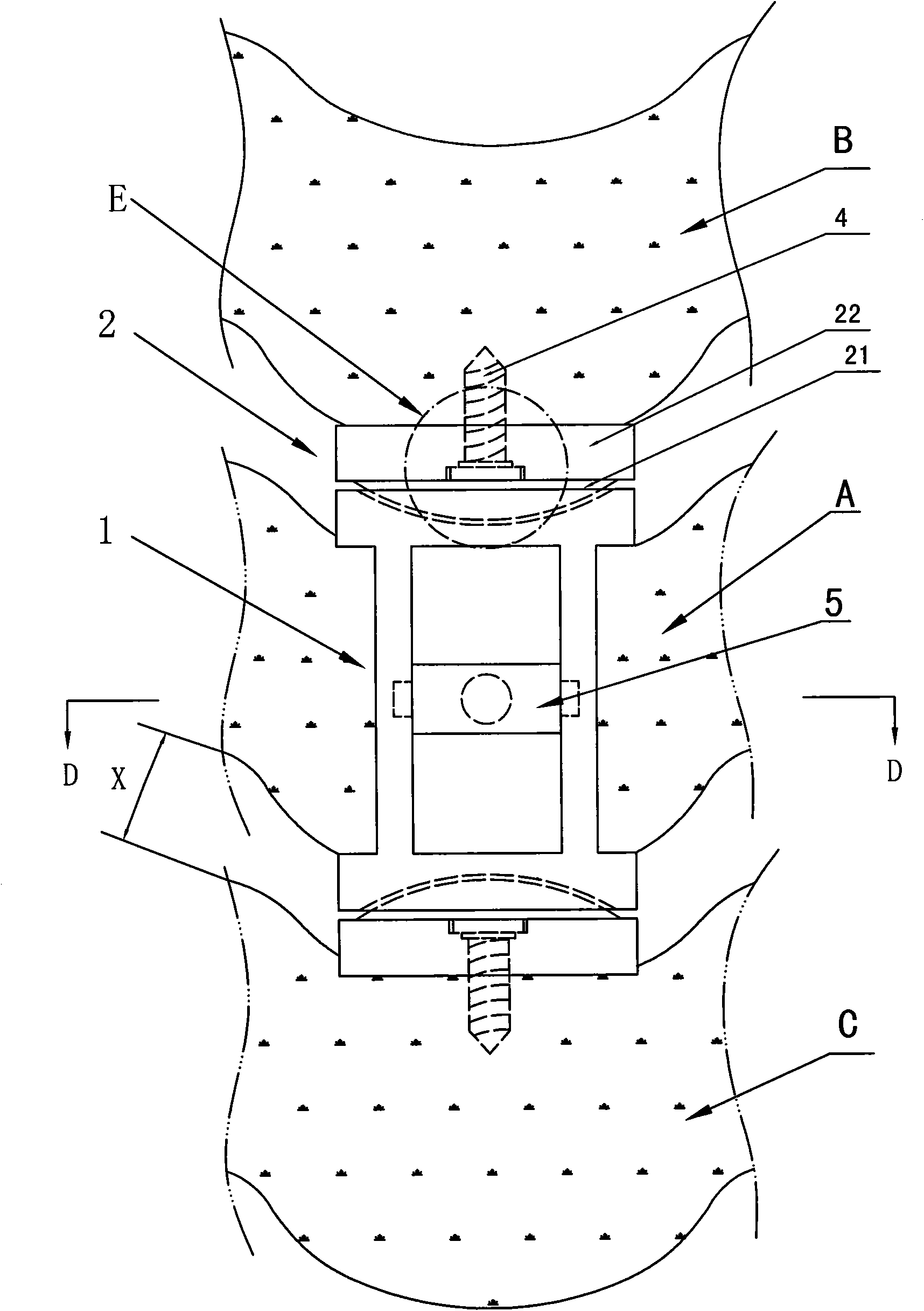 Novel cervical vertebra dynamic internal fixing device