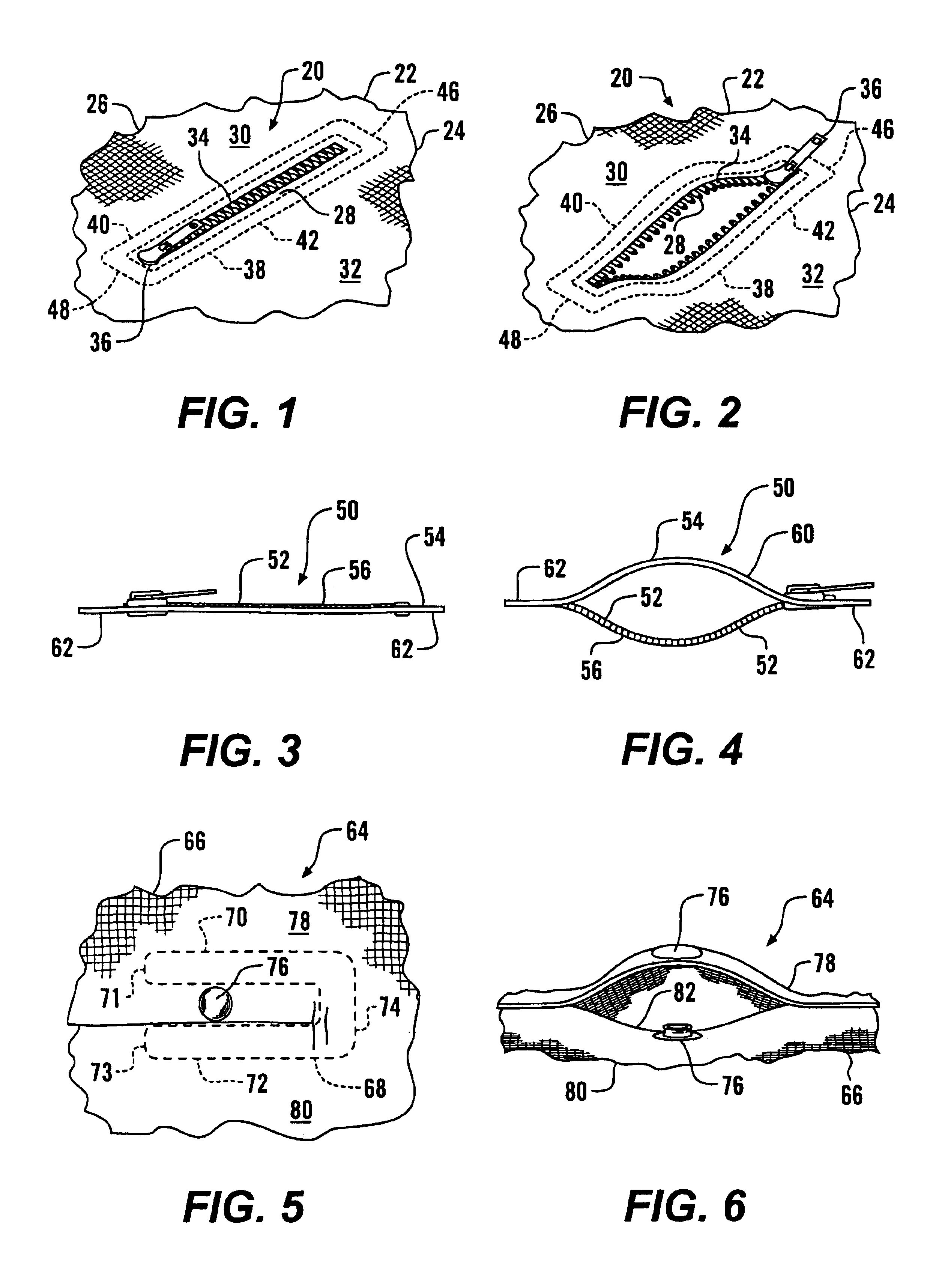 Garment with self-opening vent or pocket