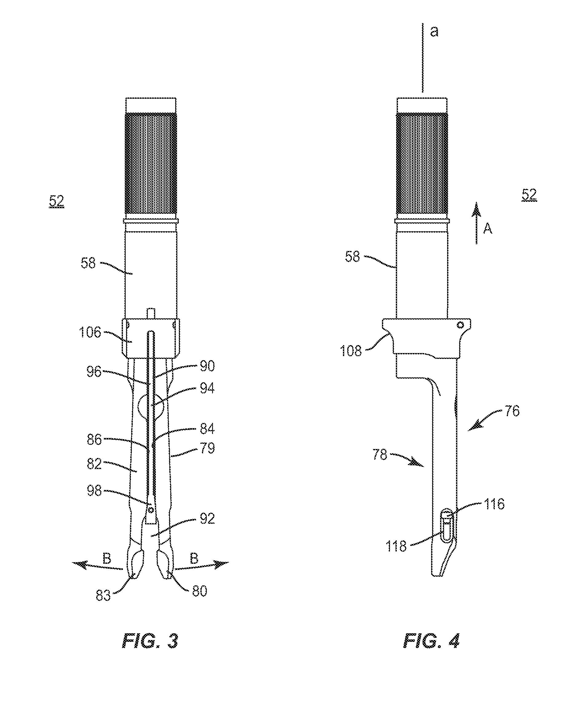 Spinal rod system and method