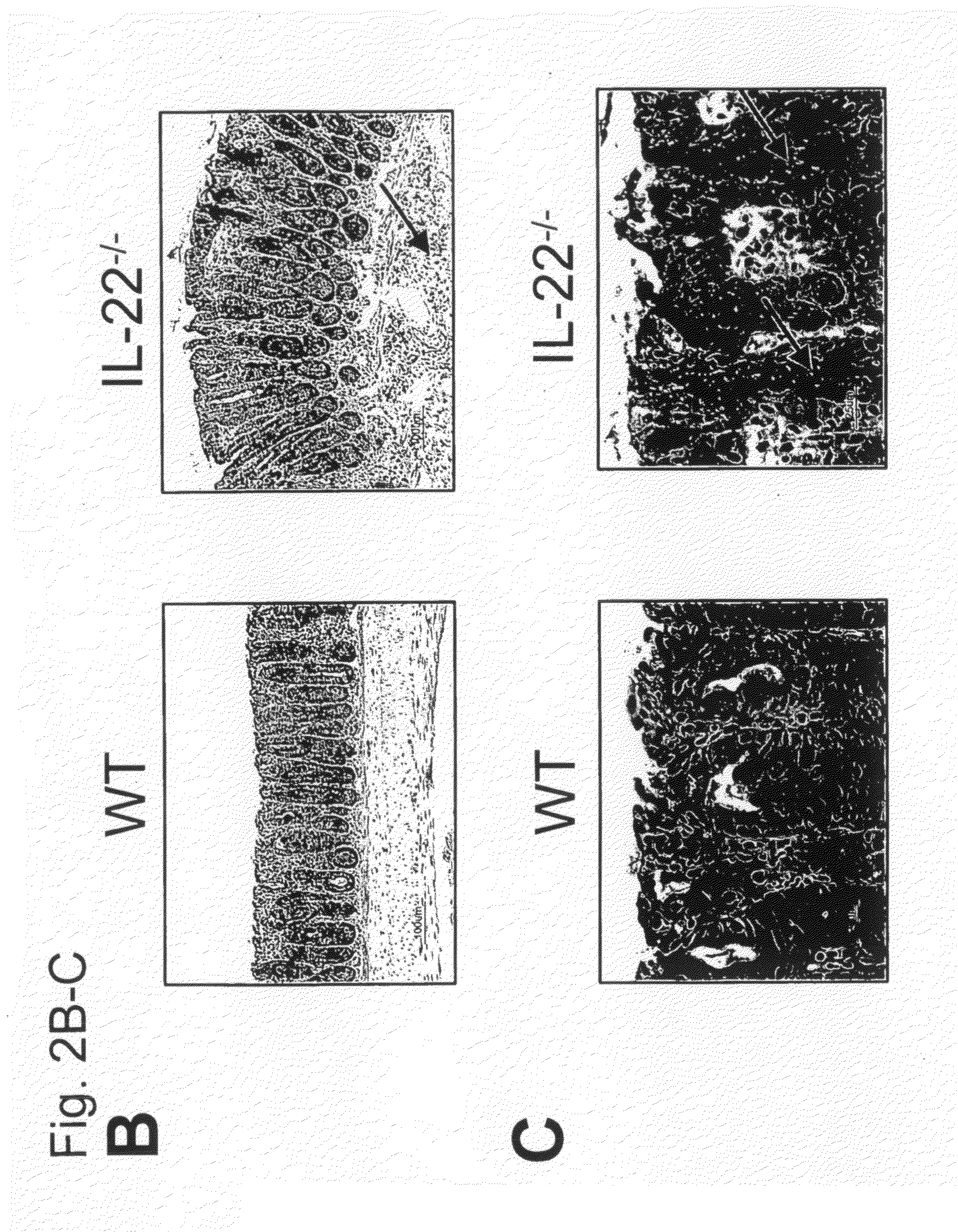 Methods for treatment of microbial disorders