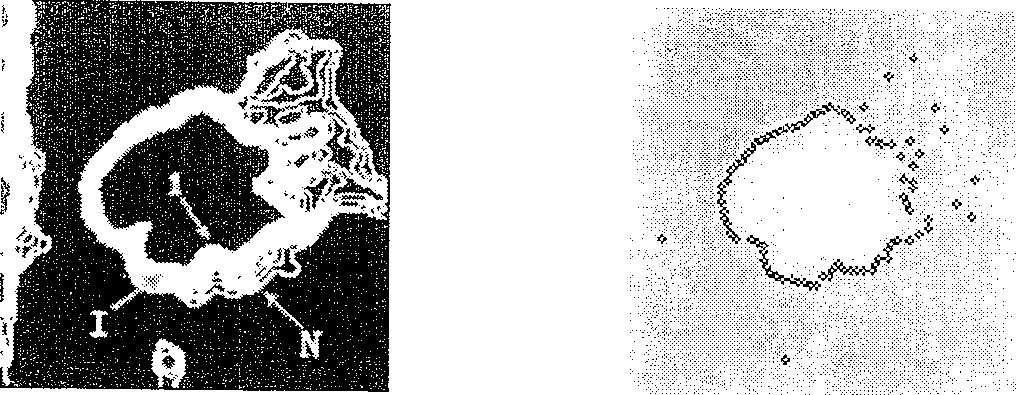 Galactophore cancer computer auxiliary diagnosis system based on galactophore X-ray radiography