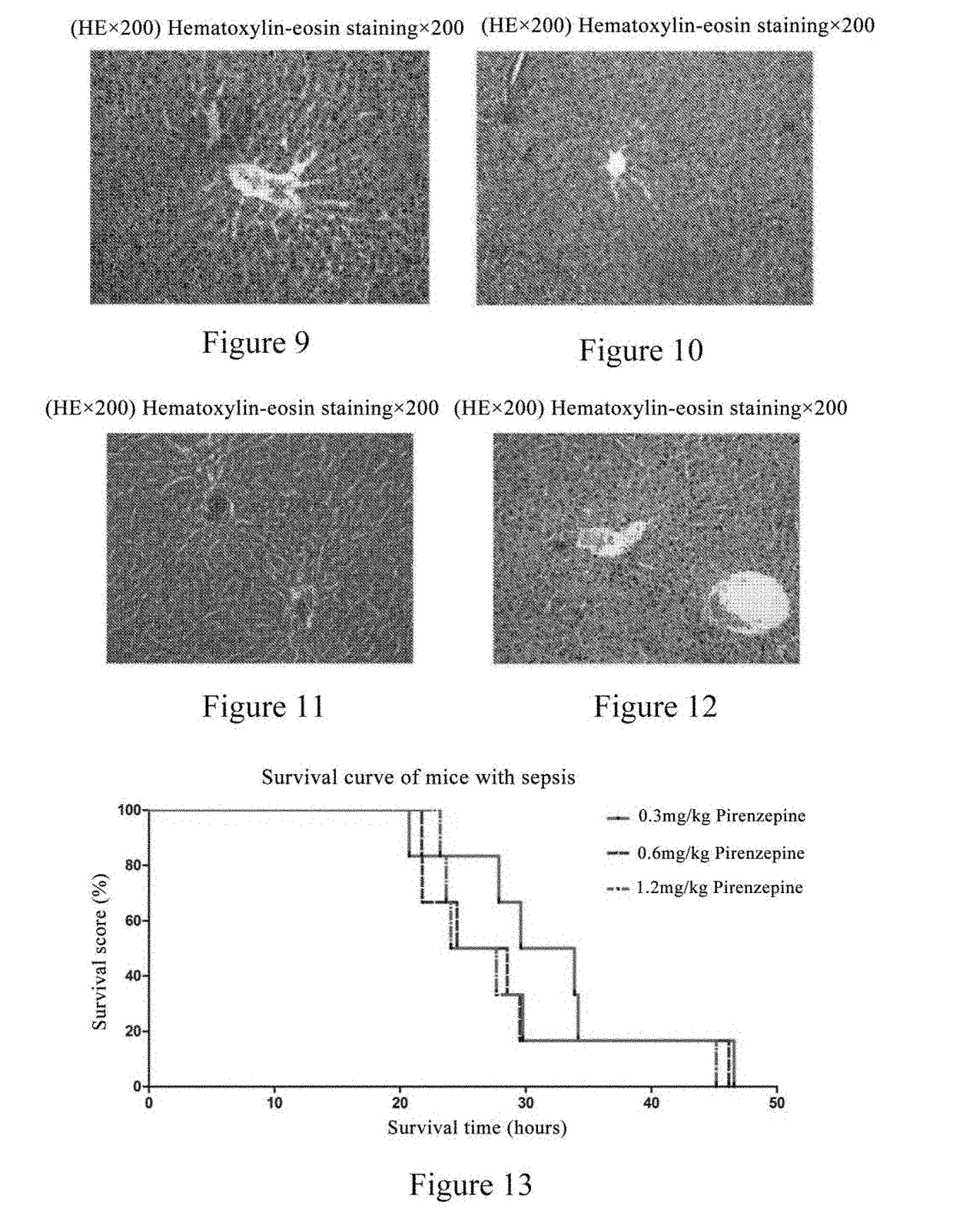 Application of pirenzepine for treating sepsis