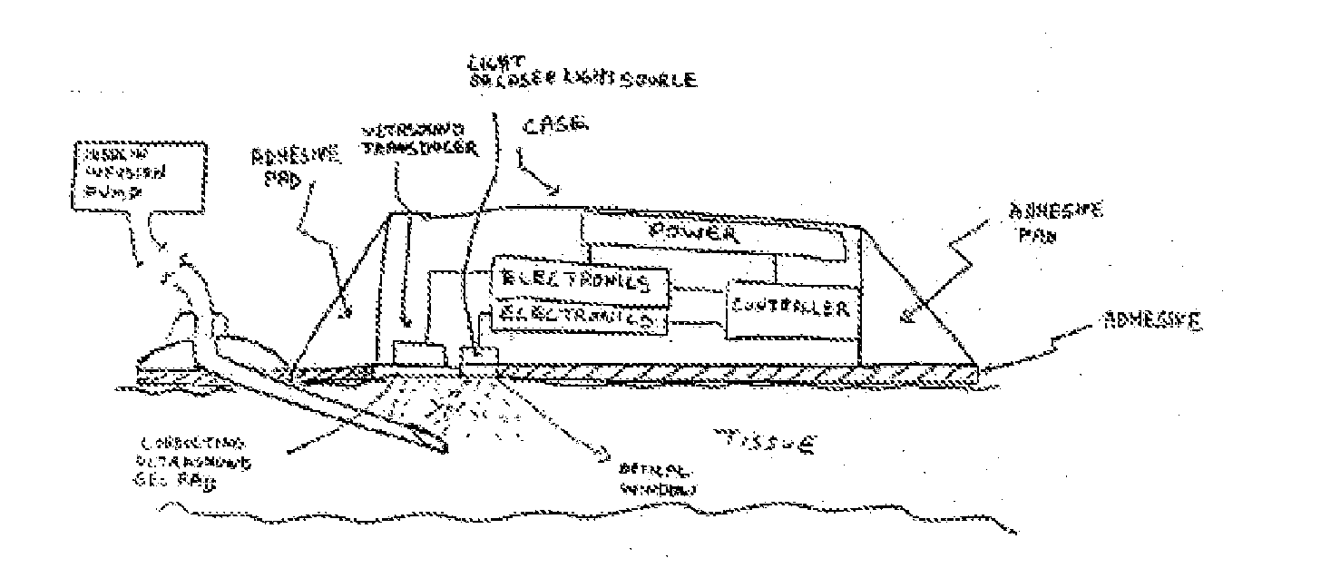 Method and device for drug delivery