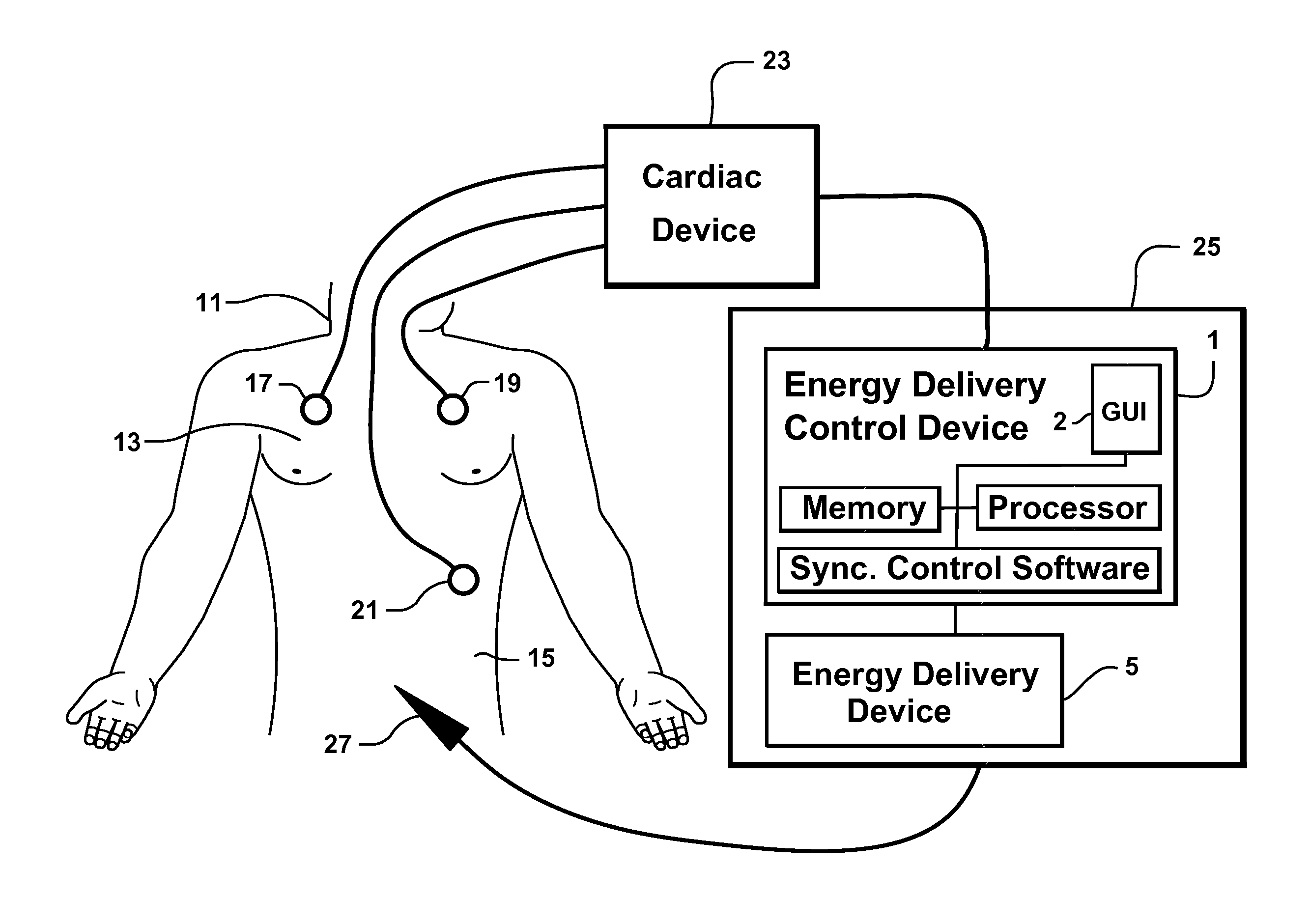 System and method for synchronizing energy delivery to the cardiac rhythm