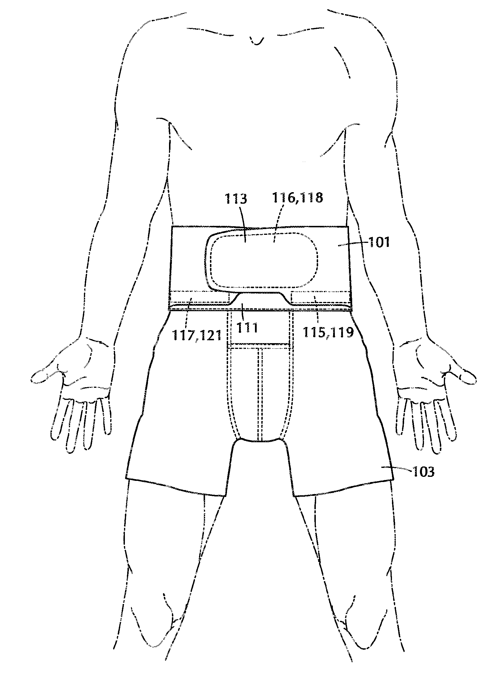 Back support garment apparatus