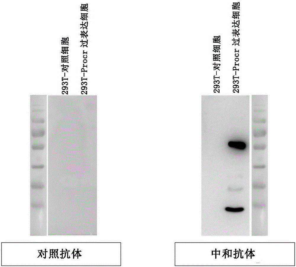 Monoclonal antibody for treating triple-negative breast cancer