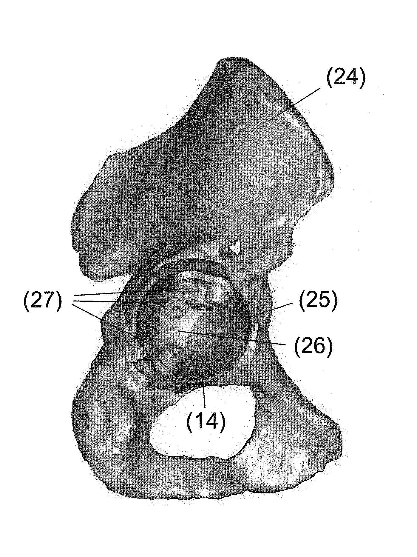 Customized surgical guides, methods for manufacturing and uses thereof