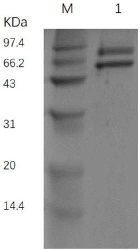 Alpha-glucosidase mutant and application thereof