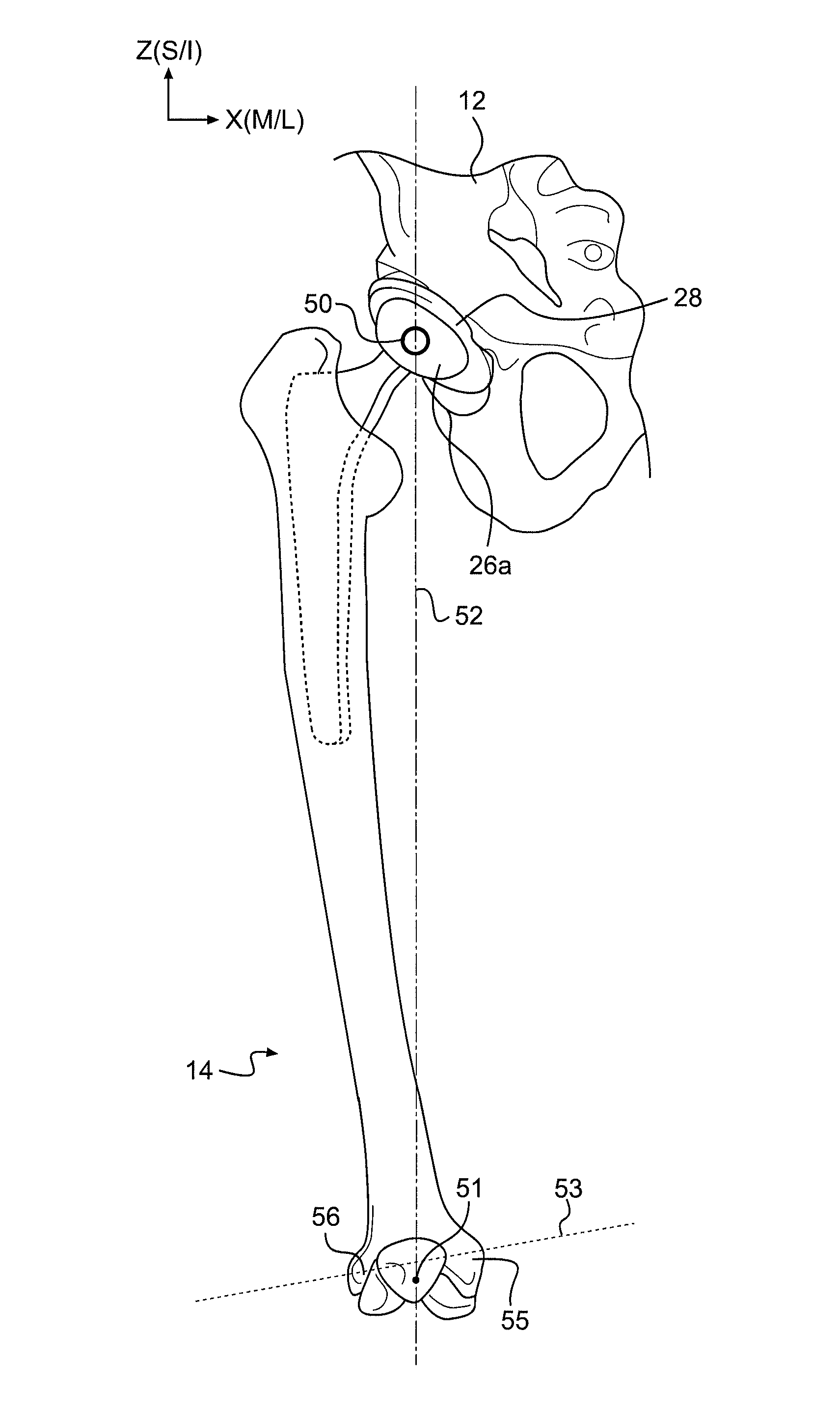 Systems and methods for measuring parameters in joint replacement surgery