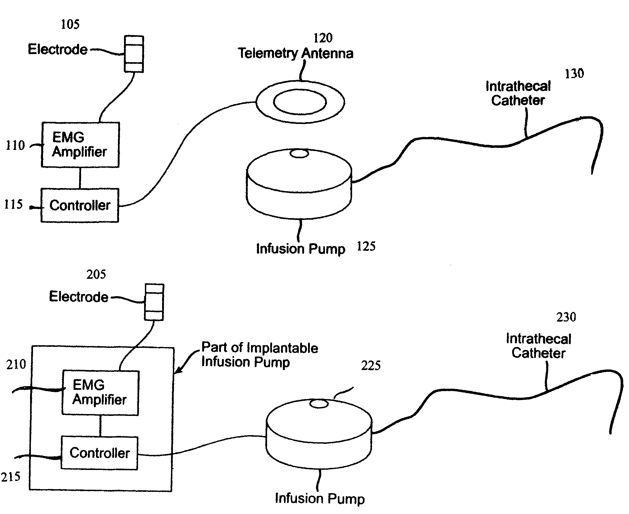 Closed loop system and method for controlling muscle activity via an intrathecal catheter