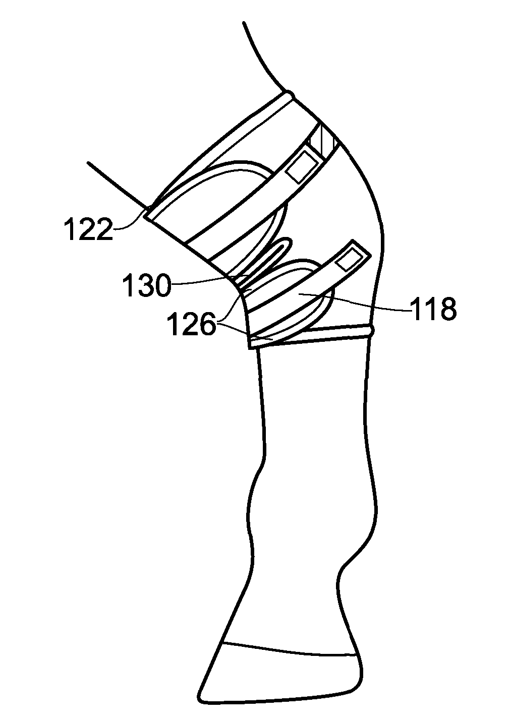 Laminated bandage comprising an activated carbon cloth