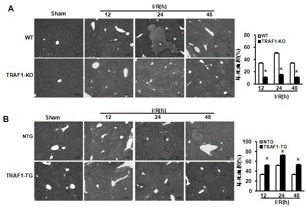 Application of TNF receptor-related factor 1 (tarf1) and its inhibitors in liver ischemic diseases