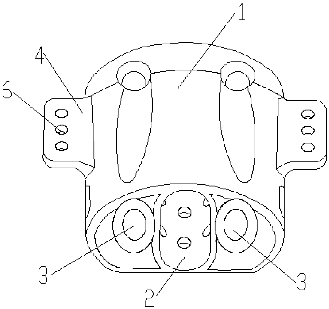 Human sacral prosthesis fusion device and preparation method thereof