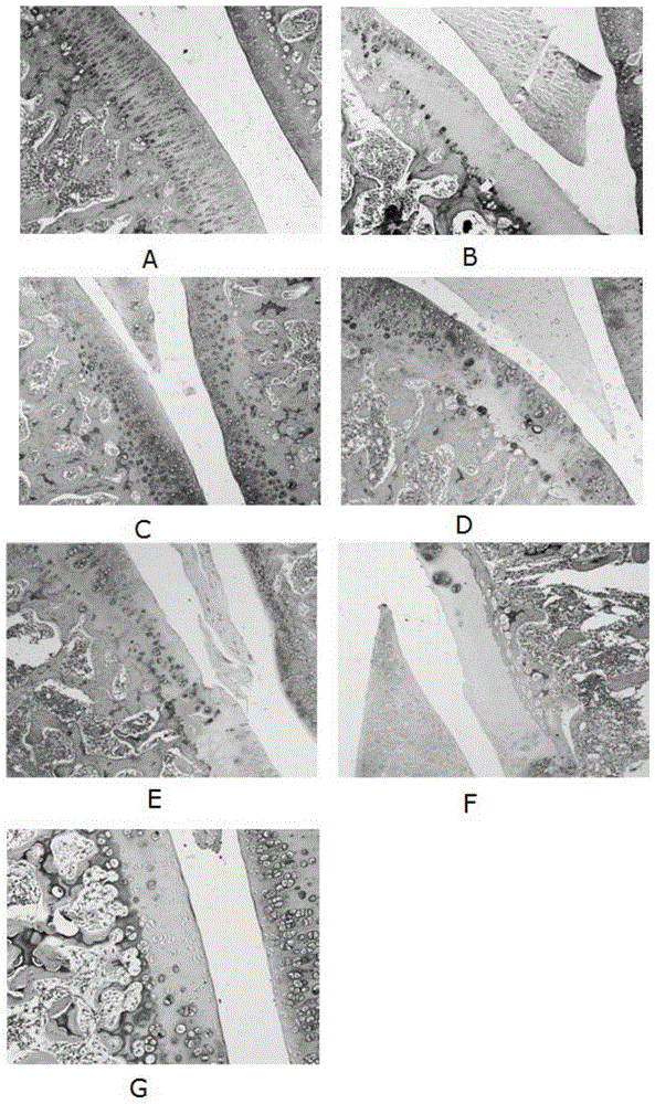 Medicament composition for treating osteoarthrosis and application of medicament composition