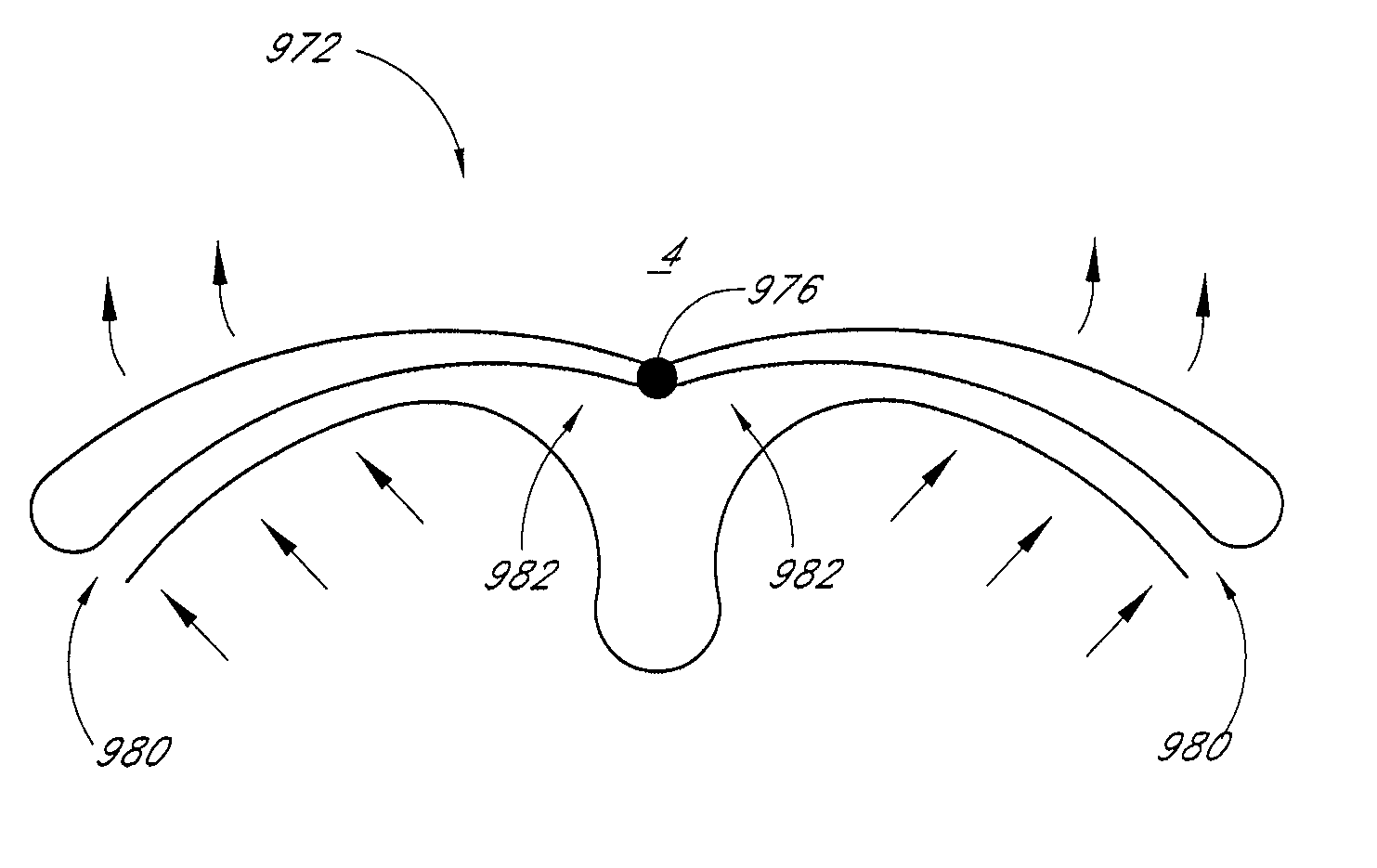 System and method for percutaneous palate remodeling