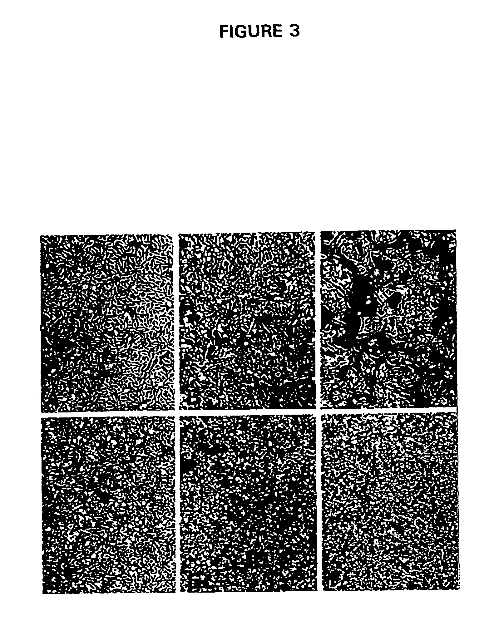 Adenovirus supervector system