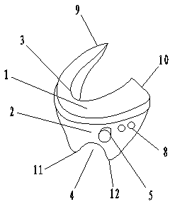 Femoral calcar osteotomy positioning guide platform