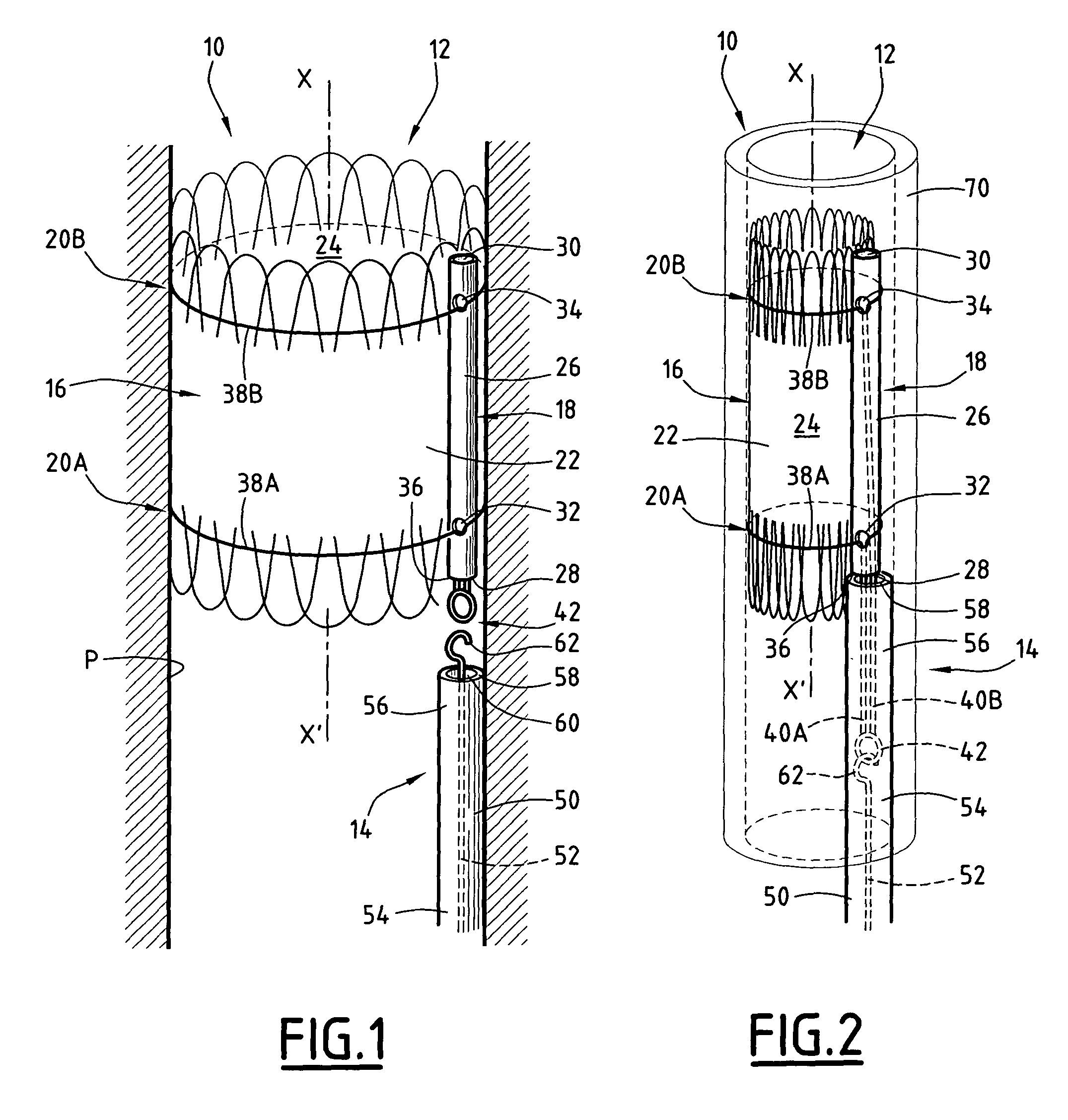 Device for treating a blood vessel and associated treatment kit