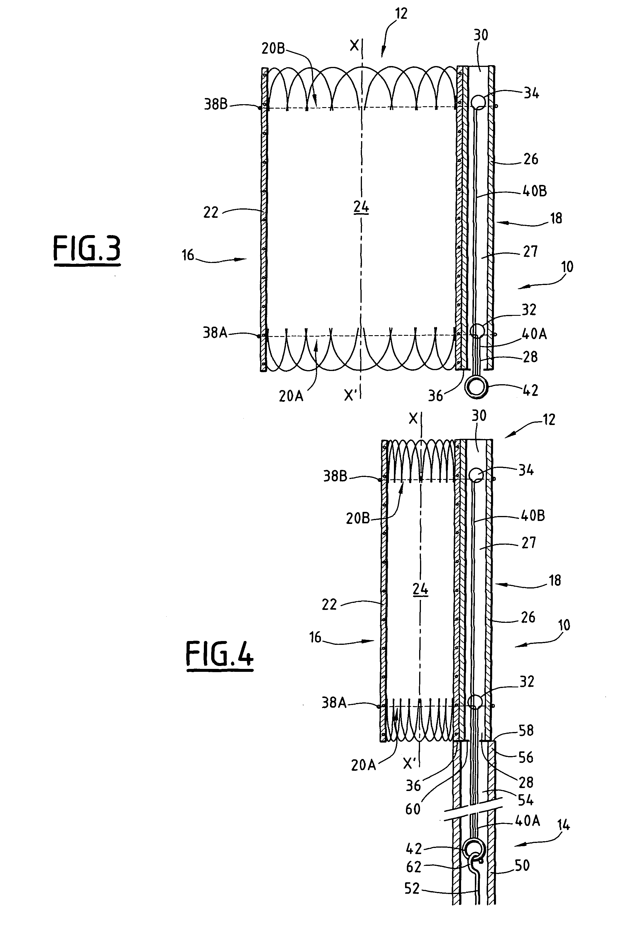 Device for treating a blood vessel and associated treatment kit