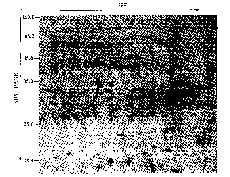 Dimensional electrophoresis method for total protein of jute root system