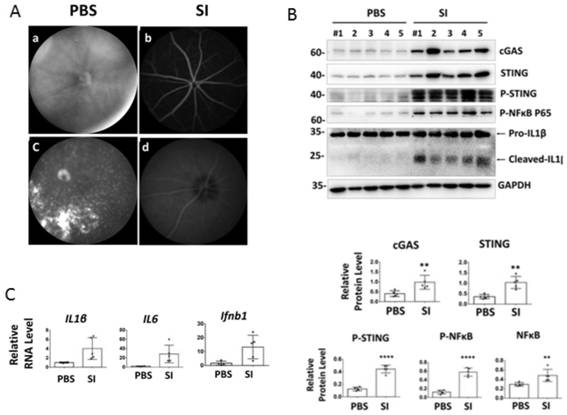 Applications of small molecule drug (+)-JQ1 in drugs for treating geographic atrophy type age-related macular degeneration