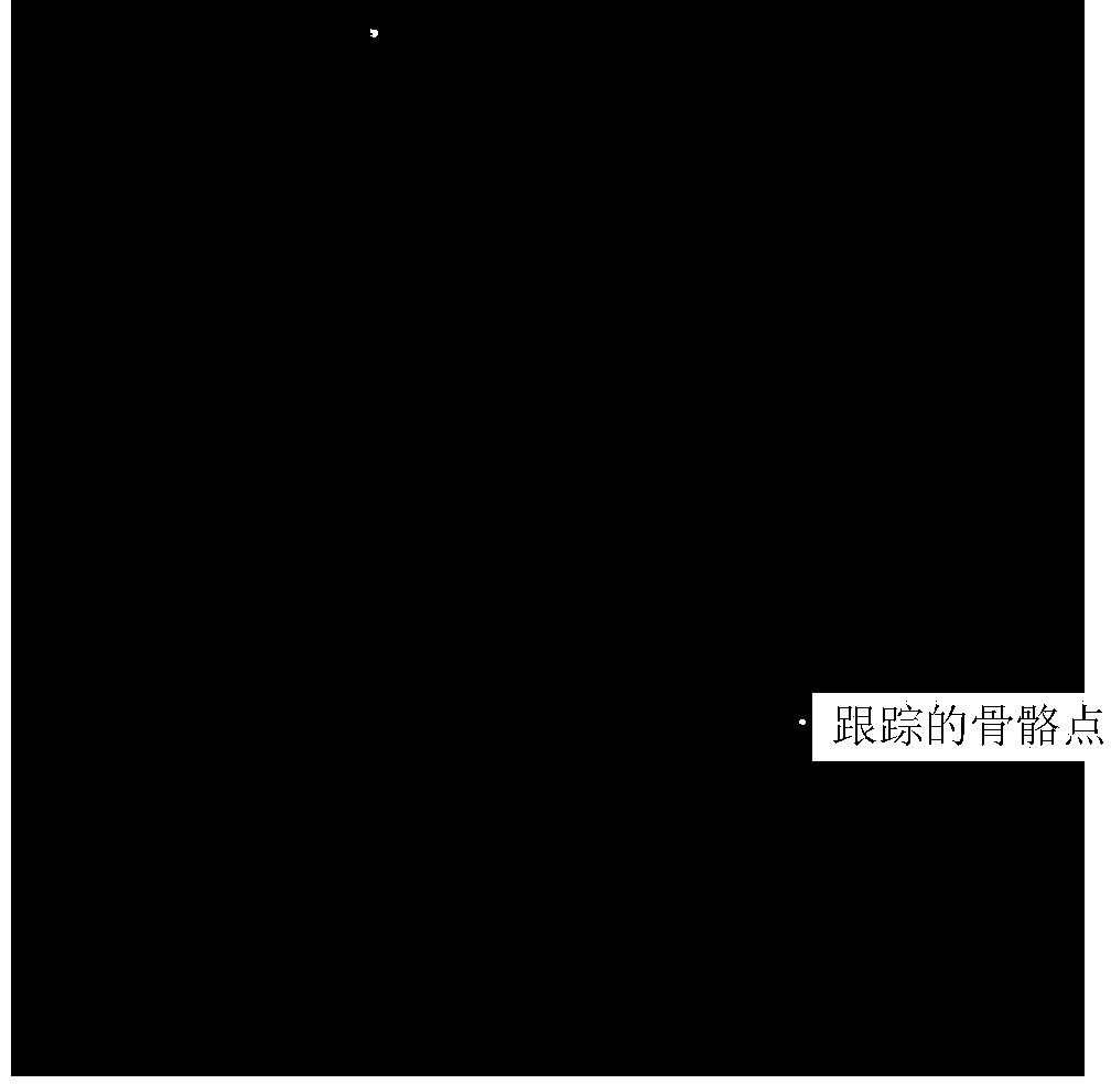 Separation estimation method of multiple motion parameters in X-ray angiographic image