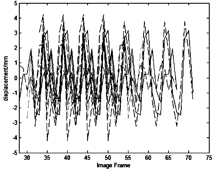 Separation estimation method of multiple motion parameters in X-ray angiographic image